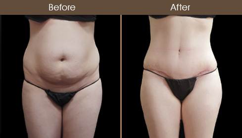 20202705154143_B173-front-view